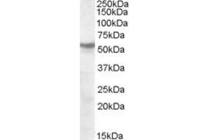 ABIN263185 (1µg/ml) staining of human cerebellum lysate (35µg protein in RIPA buffer). (CHRNB1 antibody  (Internal Region))