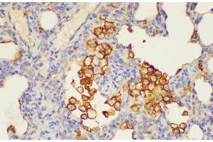 Immunohistochemistry of paraffin-embedded Rat lung using ANXA5 Ployclonal Antibody at dilution of 1:100. (Annexin V antibody)