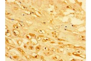 Immunohistochemistry of paraffin-embedded human placenta tissue using ABIN7157336 at dilution of 1:100 (KRTAP23-1 antibody  (AA 1-65))