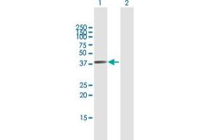 Western Blot analysis of FTSJ1 expression in transfected 293T cell line by FTSJ1 MaxPab polyclonal antibody. (FTSJ1 antibody  (AA 1-329))