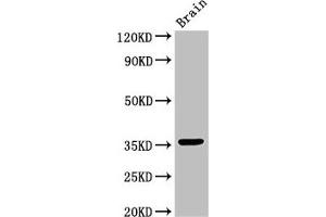 Western Blot Positive WB detected in: Mouse brain tissue All lanes: MNAT1 antibody at 3 μg/mL Secondary Goat polyclonal to rabbit IgG at 1/50000 dilution Predicted band size: 36, 32 kDa Observed band size: 36 kDa (MNAT1 antibody  (AA 1-309))