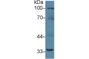 Western Blotting (WB) image for anti-Tumor Necrosis Factor Receptor Superfamily, Member 11a, NFKB Activator (TNFRSF11A) (AA 359-542) antibody (ABIN7439945)