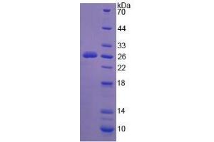 Image no. 1 for Sialidase 1 (Lysosomal Sialidase) (NEU1) (AA 141-286) (Active) protein (His tag) (ABIN6239835) (NEU1 Protein (AA 141-286) (His tag))