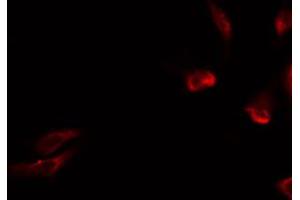 ABIN6274731 staining HeLa by IF/ICC. (MRPL15 antibody  (Internal Region))