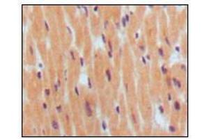 Immunohistochemical analysis of paraffin-embedded human normal myocardium, showing cytoplasmic localization using BNP1 mouse mAb with DAB staining. (BNP antibody)