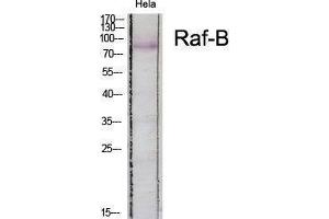 Western Blotting (WB) image for anti-B-Raf proto-oncogene, serine/threonine kinase (BRAF) (Ser185) antibody (ABIN3180842) (BRAF antibody  (Ser185))