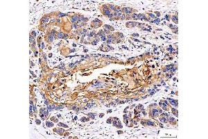 IHC analysis of EML4 using anti-EML4 antibody (ABIN6719384). (EML4 antibody  (AA 207-423))