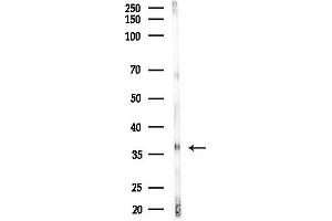 anti-Ring Finger Protein 113B (RNF113B) (Internal Region) antibody