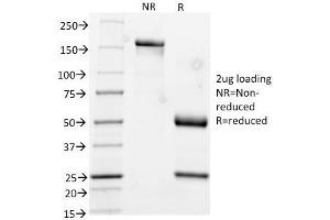 SDS-PAGE Analysis Purified CK17 Mouse Monoclonal Antibody (KRT17/778). (KRT17 antibody)