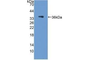 Detection of Recombinant PCX, Rat using Polyclonal Antibody to Podocalyxin (PODXL) (PODXL antibody  (AA 153-386))
