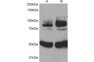 Western blot testing of rat aortic smooth muscle cells before (1) and after (2) infection with human APPL1 adenovirus for 48hrs. (APPL1 antibody)