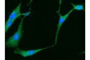 ICC/IF analysis of NSE in U87MG cells line, stained with DAPI (Blue) for nucleus staining and monoclonal anti-human NSE antibody (1:100) with goat anti-mouse IgG-Alexa fluor 488 conjugate (Green). (ENO2/NSE antibody  (AA 1-434))