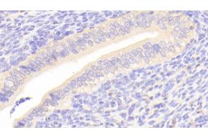 Detection of SCRN1 in Mouse Uterus Tissue using Polyclonal Antibody to Secernin 1 (SCRN1) (Secernin 1 antibody  (AA 2-414))