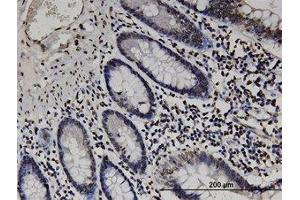 Image no. 1 for anti-RAB GTPase Activating Protein 1-Like (RABGAP1L) (AA 1-111) antibody (ABIN599499) (RABGAP1L antibody  (AA 1-111))