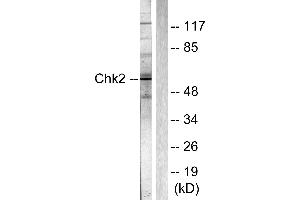 Western blot analysis of extracts from Jurkat cells, using Chk2 (Ab-387) Antibody (#B0414). (CHEK2 antibody  (Thr387))