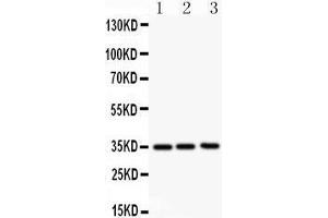 Western Blotting (WB) image for anti-Colony Stimulating Factor 2 (Granulocyte-Macrophage) (CSF2) (AA 63-81), (Middle Region) antibody (ABIN3043206)