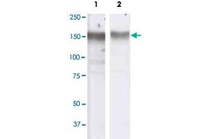 HT-29 cell lysate was used with EGFR monoclonal antibody, clone SB41a  , 1st lane, and Mouse Anti-EGFR-HRP, 2 nd lane. (EGFR antibody)