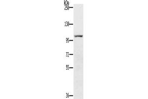 Gel: 6 % SDS-PAGE, Lysate: 40 μg, Lane: 293T cells, Primary antibody: ABIN7191822(PDE5A Antibody) at dilution 1/200, Secondary antibody: Goat anti rabbit IgG at 1/8000 dilution, Exposure time: 2 minutes (PDE5A antibody)