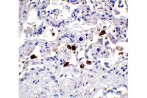 Immunohistochemistry (IHC) image for anti-SARS-CoV-2 Spike (C-Term) antibody (ABIN1030641)