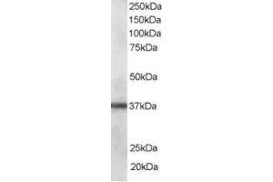 Western Blotting (WB) image for anti-PDZ and LIM Domain 1 (PDLIM1) (C-Term) antibody (ABIN2466090) (PDLIM1 antibody  (C-Term))