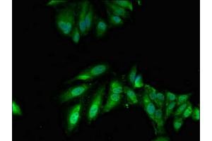 Immunofluorescent analysis of Hela cells using ABIN7173936 at dilution of 1:100 and Alexa Fluor 488-congugated AffiniPure Goat Anti-Rabbit IgG(H+L) (TWF1 antibody  (AA 199-252))