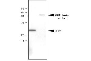 Western Blotting (WB) image for anti-Glutathione S Transferase (GST) antibody (ABIN165402)