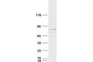 Validation with Western Blot