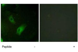 Immunofluorescence analysis of HeLa cells, using ACO1 polyclonal antibody . (Aconitase 1 antibody)