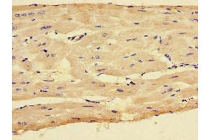 Immunohistochemistry of paraffin-embedded human heart tissue using ABIN7148772 at dilution of 1:100 (CX3CR1 antibody  (AA 298-351))