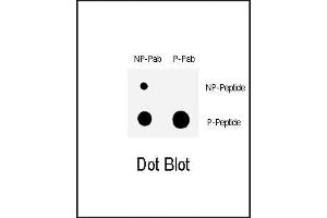 Image no. 2 for anti-WEE1 Homolog (S. Pombe) (WEE1) (pSer123) antibody (ABIN358251) (WEE1 antibody  (pSer123))