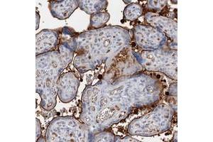 Immunohistochemical staining of human placenta with SNX22 polyclonal antibody  shows strong membranous positivity in trophoblastic cells at 1:500-1:1000 dilution. (SNX22 antibody)