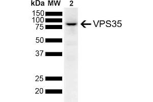 Western Blot analysis of Human SH-SY5Y lysates showing detection of 91. (VPS35 antibody  (PE))