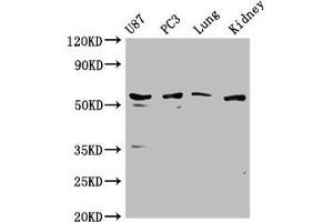 Western Blot Positive WB detected in: U87 whole cell lysate, PC3 whole cell lysate, Mouse lung tissue, Mouse kidney tissue All lanes: PPP5C antibody at 1:1000 Secondary Goat polyclonal to rabbit IgG at 1/50000 dilution Predicted band size: 57 kDa Observed band size: 57 kDa (PP5 antibody  (AA 370-488))