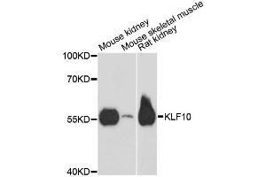 Western blot analysis of extracts of various cell lines, using KLF10 antibody. (KLF10/TIEG1 antibody  (AA 161-365))