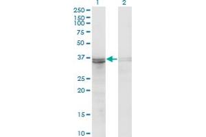 Western Blot analysis of FRZB expression in transfected 293T cell line by FRZB monoclonal antibody (M06), clone 3F4. (FRZB antibody  (AA 102-190))