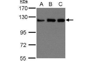 WB Image Sample (30 ug of whole cell lysate) A: 293T B: A431 , C: H1299 15% SDS PAGE antibody diluted at 1:1500 (KIF5B antibody  (C-Term))