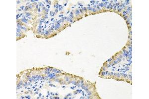 Immunohistochemistry of paraffin-embedded Mouse lung using STRN3 Polyclonal Antibody at dilution of 1:100 (40x lens).