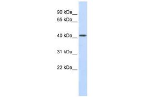 Carboxypeptidase B2 antibody used at 1 ug/ml to detect target protein.
