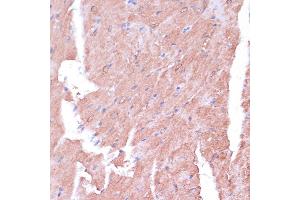 Immunohistochemistry of paraffin-embedded mouse heart using TIMM8B antibody (ABIN7270928) at dilution of 1:100 (40x lens). (TIMM8B antibody  (AA 16-98))