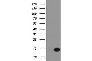 HEK293T cells were transfected with the pCMV6-ENTRY control (Left lane) or pCMV6-ENTRY C17orf37 (Right lane) cDNA for 48 hrs and lysed. (C17orf37 antibody)