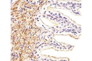 Immunohistochemical analysis of paraffin-embedded human prostate section using ATF6 beta antibody at 1:25. (ATF6B antibody  (AA 560-589))