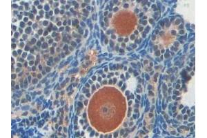 Immunohistochemistry (IHC) image for anti-Poly (ADP-Ribose) Polymerase 1 (PARP1) (AA 661-881) antibody (ABIN7439663)