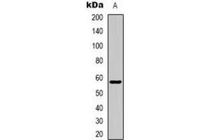 Western blot analysis of ZNF596 expression in Jurkat (A) whole cell lysates. (ZNF596 antibody)