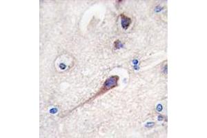 Image no. 3 for anti-Hippocalcin (HPCA) (N-Term) antibody (ABIN357112) (Hippocalcin antibody  (N-Term))