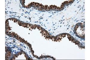 Image no. 2 for anti-Acetyl-CoA Acetyltransferase 2 (ACAT2) antibody (ABIN1496404) (ACAT2 antibody)