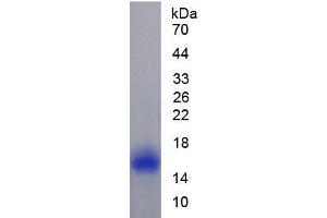 SDS-PAGE analysis of Rat Caveolin 1 Protein.