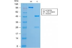 SDS-PAGE Analysis of Purified Estrogen Receptor, alpha Rabbit Recombinant Monoclonal Antibody (ESR1/2299R). (Recombinant Estrogen Receptor alpha antibody)