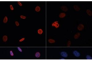 Immunofluorescence analysis of NIH/3T3 cells using Acetyl-Histone H2B-K15 Polyclonal Antibody at dilution of 1:100. (Histone H2B antibody  (acLys15))