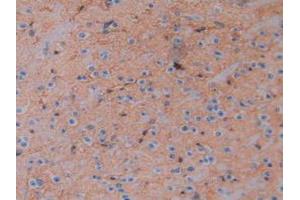 IHC-P analysis of Mouse Brain Tissue, with DAB staining. (Aquaporin 4 antibody  (AA 177-304))