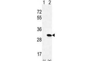 Western Blotting (WB) image for anti-HRas proto-oncogene, GTPase (HRAS) antibody (ABIN2996311) (HRAS antibody)